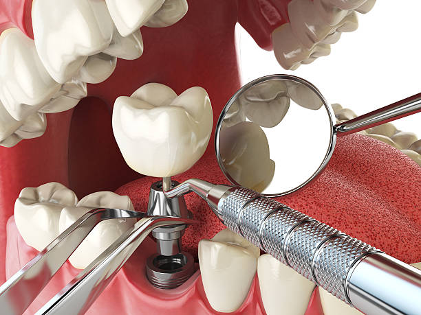 Best Weekend Emergency Dentist in Canton, TX
