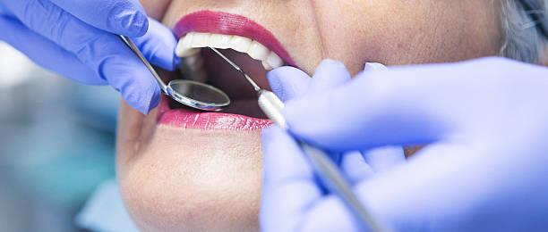 Best Emergency Tooth Extraction in Canton, TX